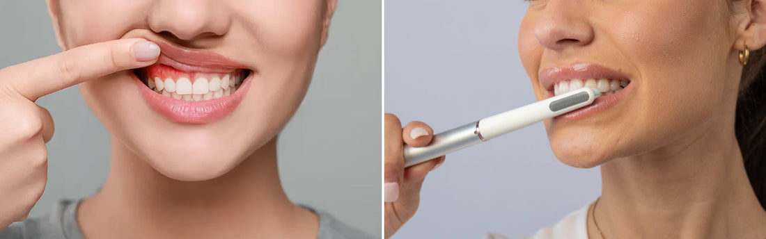 How Do You Choose the Right Pro-Pulse Mode for Sensitive Teeth?